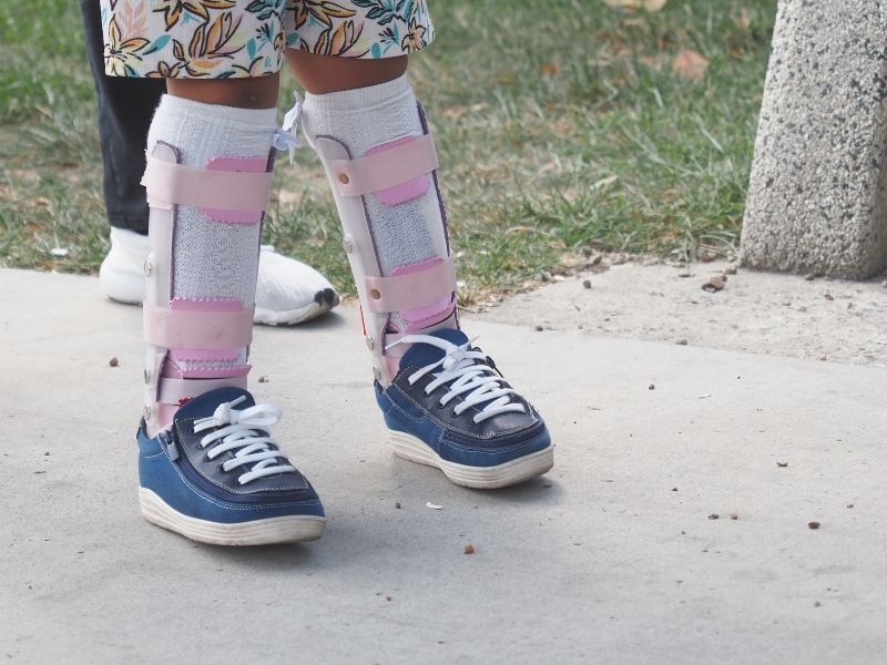 how-is-walking-disorder-evaluated-in-children-with-cerebral-palsy